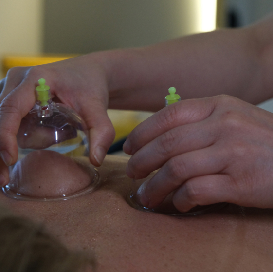 cupping process